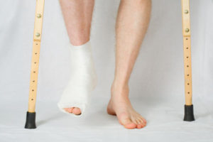 ankle_fracture